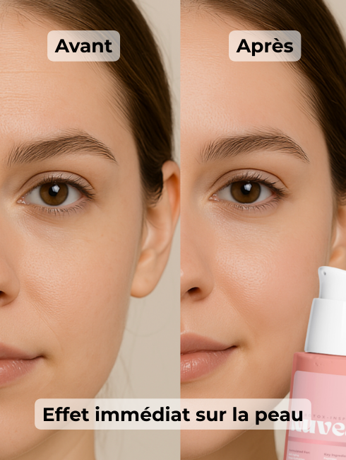 Nuvear | Botox-Inspired | FR